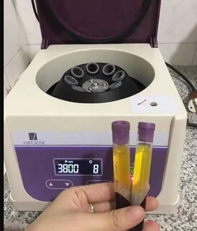 Virtuose PRP Mini Low-Speed Centrifuge - Image 3