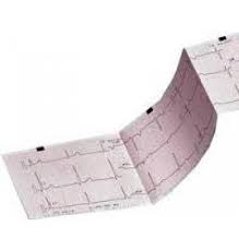 170 Series Doppler Recording Paper 2104907-001 – GE Healthcare