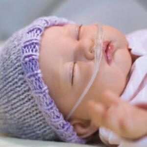 Alternative view of Nasal Cannula – Neonatal/Infant
