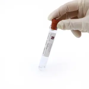 Alternative view of 9ml Activator PRP Tube With Activato | Single