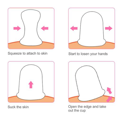 Silicone Cupping Set 7pc - Pink - Image 4