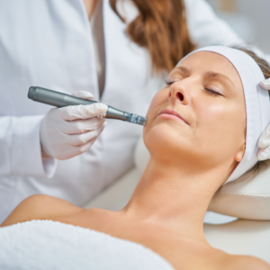 Alternative view of Microneedling Training - One-on-one