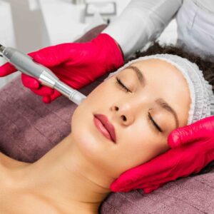 Alternative view of Microneedling - Online Course