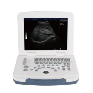 Alternative view of B/W Laptop Ultrasound DW-580 + 2 probes