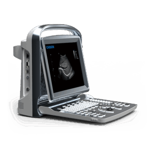 Alternative view of CHISON ECO1 B&W ULTRASOUND | 2 Probe Connectors and battery