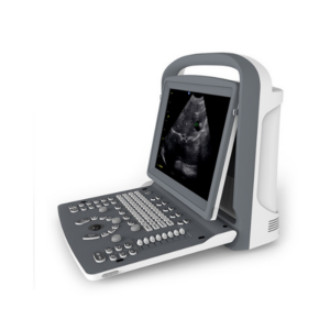 Alternative view of Chison ECO2 Portable Ultrasound Machine