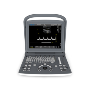 Chison ECO2 Portable Ultrasound Machine