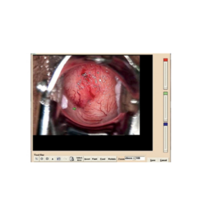 COLPOSCOPY SOFTWARE for 29620, 29622, 29600 with 29603