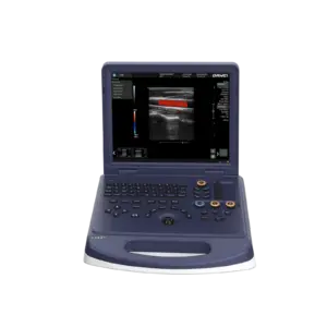 Alternative view of DW-L3 Obstetrics 2D 3D color Doppler ultrasound machine