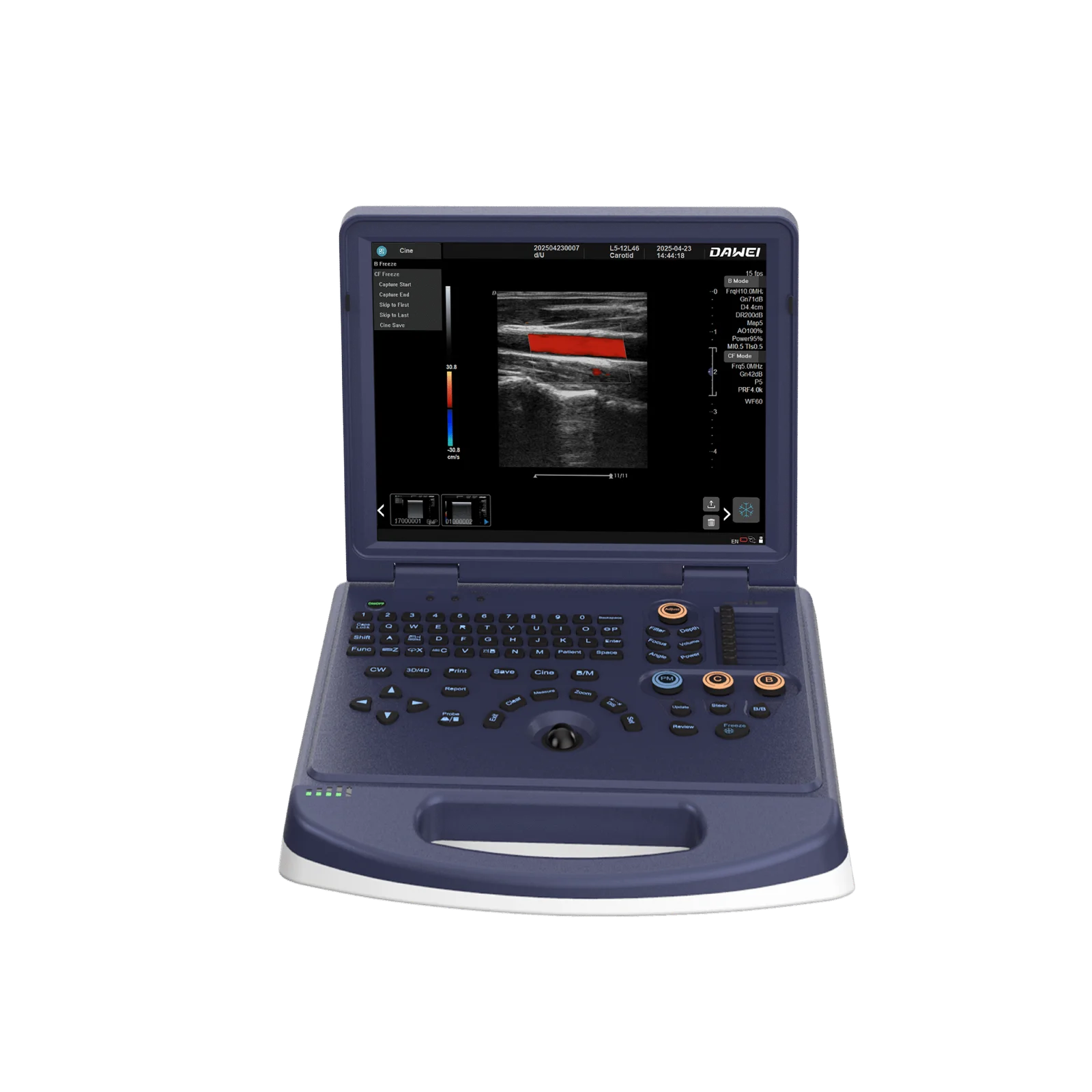 DW-L3 Obstetrics 2D 3D color Doppler ultrasound machine - Image 2