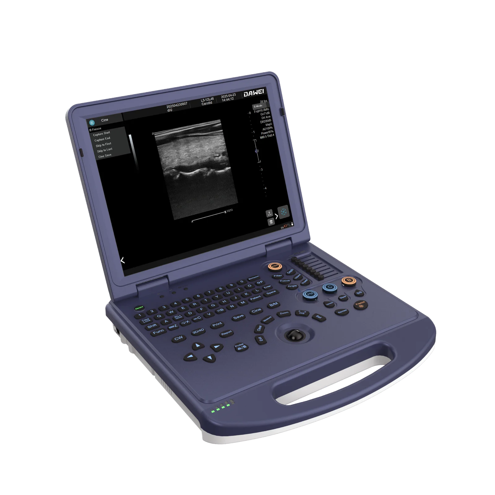 DW-L3 Obstetrics 2D 3D color Doppler ultrasound machine - Image 3