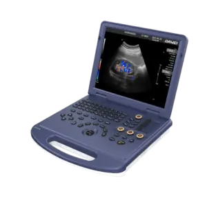 DW-L3 Obstetrics 2D 3D color Doppler ultrasound machine
