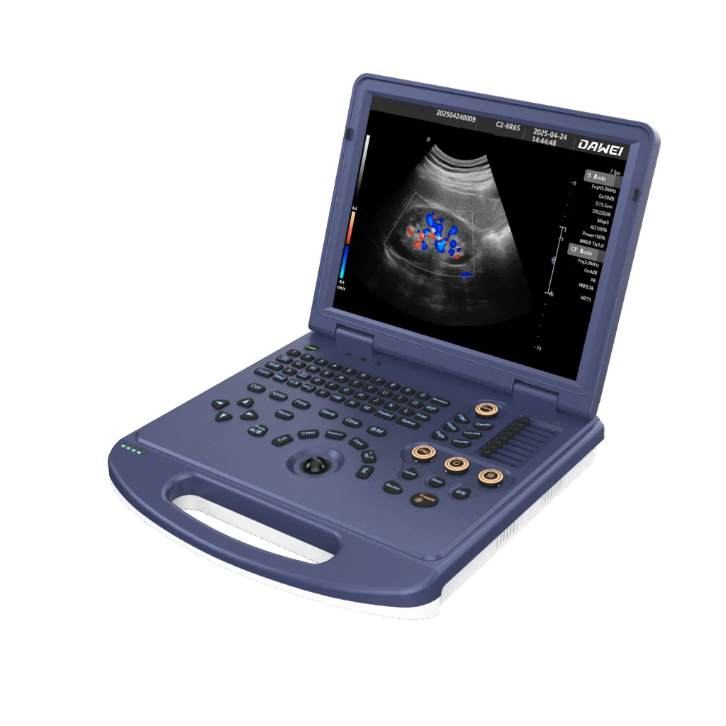 DW-L3 Obstetrics 2D 3D color Doppler ultrasound machine