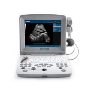 Alternative view of Edan DUS 60 Digital Ultrasound