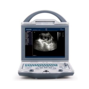 Alternative view of KX5600 Portable ultrasound Machine | Battery Operated