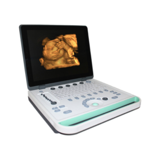 Alternative view of Laptop Ultrasound Machine MSLPU34