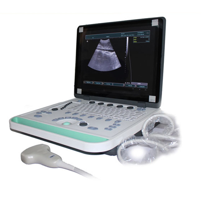 Laptop Ultrasound Machine MSLPU34