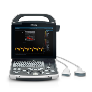 Alternative view of Mindray Ultrasound DP-30