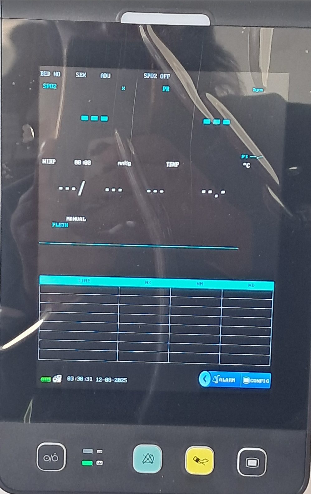 vital signs monitor-E8 8 inch monitor