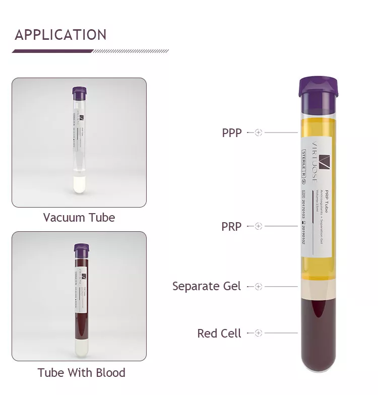 PRP Tubes | 24’S - Image 3