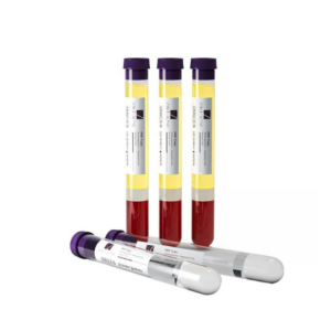 PRP Tubes | 24’S