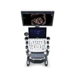 Alternative view of Sonoscape P20 3D |4D | 5D Ultrasound Color Doppler Ob/Gyn Echo Scanner