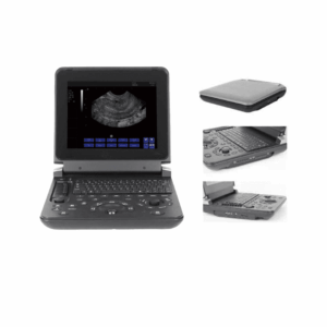 Alternative view of Ultrasound Machine - 12 Inch