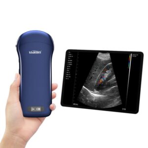 Alternative view of Viatom C10 Ultrasound | 3 in 1 Wireless Pocket | convex + Linear + Cardiac
