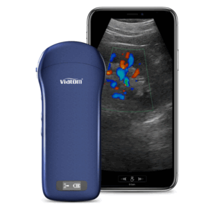 Viatom C10 Ultrasound | 3 in 1 Wireless Pocket | convex + Linear + Cardiac