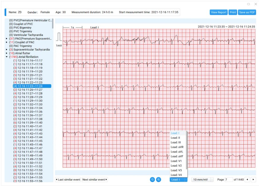 Viatom ECG recorder/holter monitor| 12 Channel + AI algorithm - Image 11