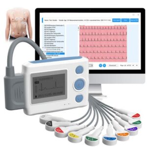 Viatom ECG recorder/holter monitor| 12 Channel + AI algorithm