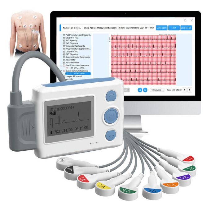Viatom ECG recorder/holter monitor| 12 Channel + AI algorithm