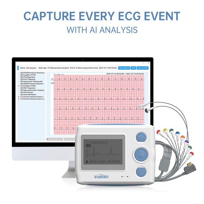 Viatom ECG recorder/holter monitor| 12 Channel + AI algorithm - Image 2