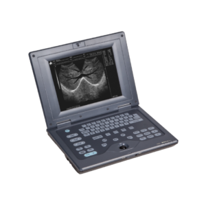 WED-2018 Notebook Full-digital Ultrasound Diagnostic System