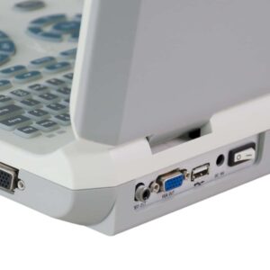 Alternative view of XF30 LED Laptop Ultrasound Scanner + Battery