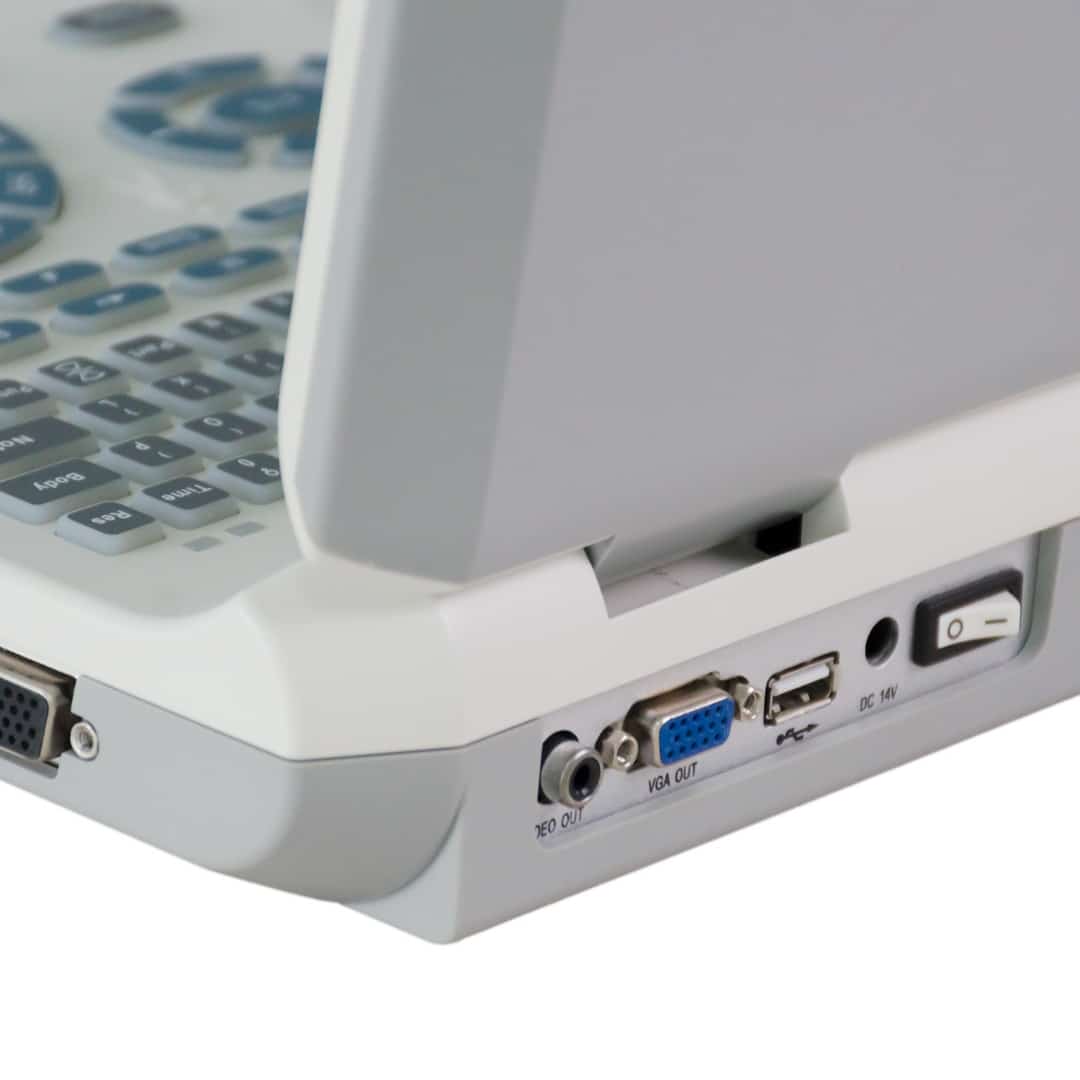 XF30 LED Laptop Ultrasound Scanner + Battery - Image 2