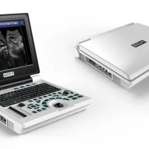 Alternative view of XF30B Fetal Biometrics Phantom Mobile Scanner Therapy Ultrasound Equipment