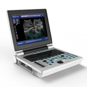 XF30B Fetal Biometrics Phantom Mobile Scanner Therapy Ultrasound Equipment
