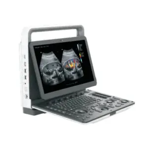 Alternative view of ZONCARE M30 Portable Color Doppler Ultrasonic System