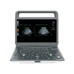 ZONCARE M30 Portable Color Doppler Ultrasonic System