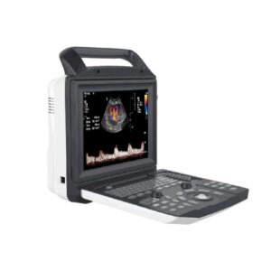 Alternative view of ZONCARE V7 Portable Color Doppler OB GYN Ultrasound
