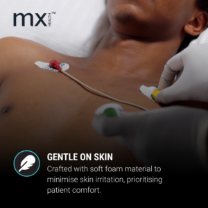 Alternative view of Mx Disposable Ecg Electrodes Pregel Ag/Agcl Sensor